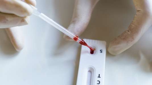 profissional manipula um teste rápido de coronavírus