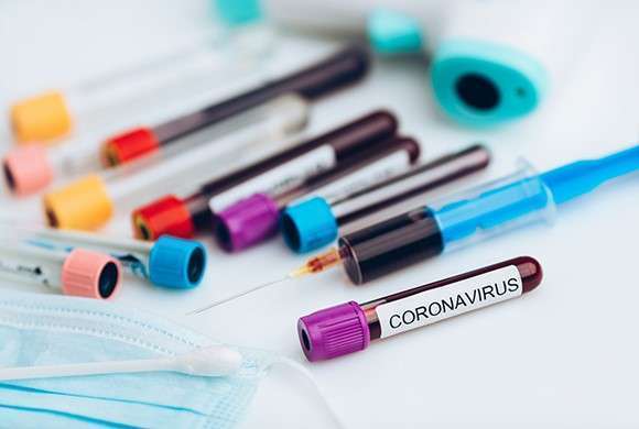 Tubos de vidro com amostras de sangue escritos coronavírus