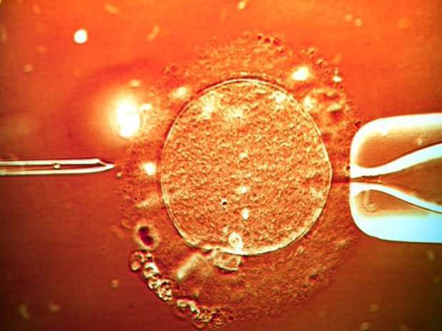 Anvisa altera regras para bancos de embriões no Brasil